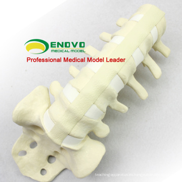 SONDAS DE SIMULACIÓN AL POR MAYOR 12313 Anatomía Médica Artificial Lumbar Model, Orthopedics Practice Simulation Bone